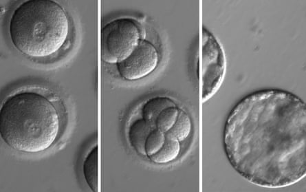 This sequence of images shows the development of embryos after injection of a gene-correcting enzyme and sperm from a donor with a genetic mutation known to cause hypertrophic cardiomyopathy.