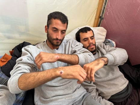 Men show marks they say were caused by handcuffs during Israeli detention