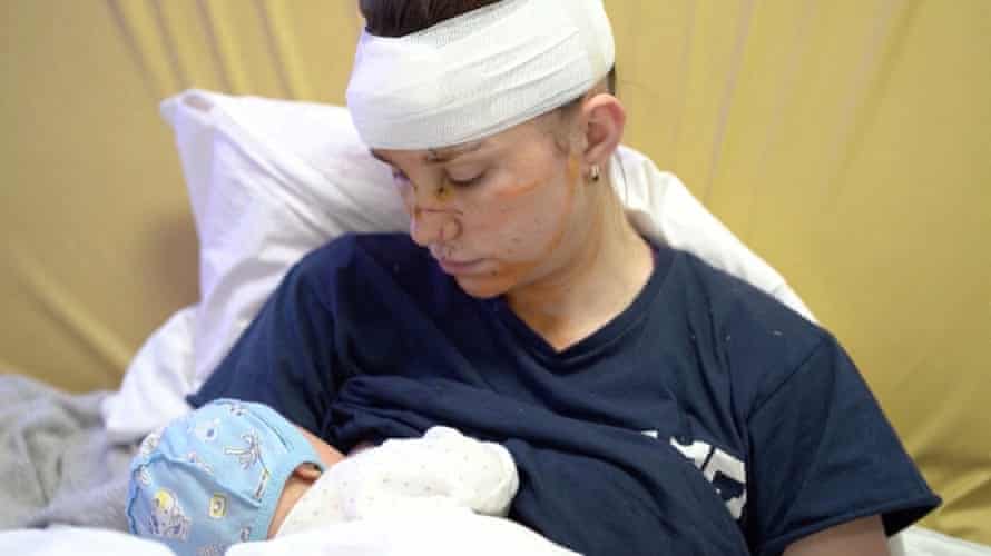 Ukrainian mother seriously wounded while shielding baby from missile strike | Ukraine 1 Olga holds her baby Victoria.