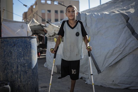 10-year-old Muhammed Omar Selim Muslih, who followed his father to get aid for their family in the Netzarim Corridor was wounded in an Israeli attack and got amputated due to shrapnel injuries.