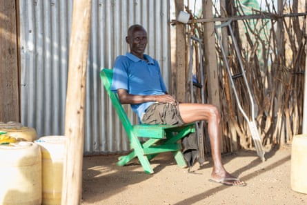 Man with half a leg missing, sitting on a chair in the sun