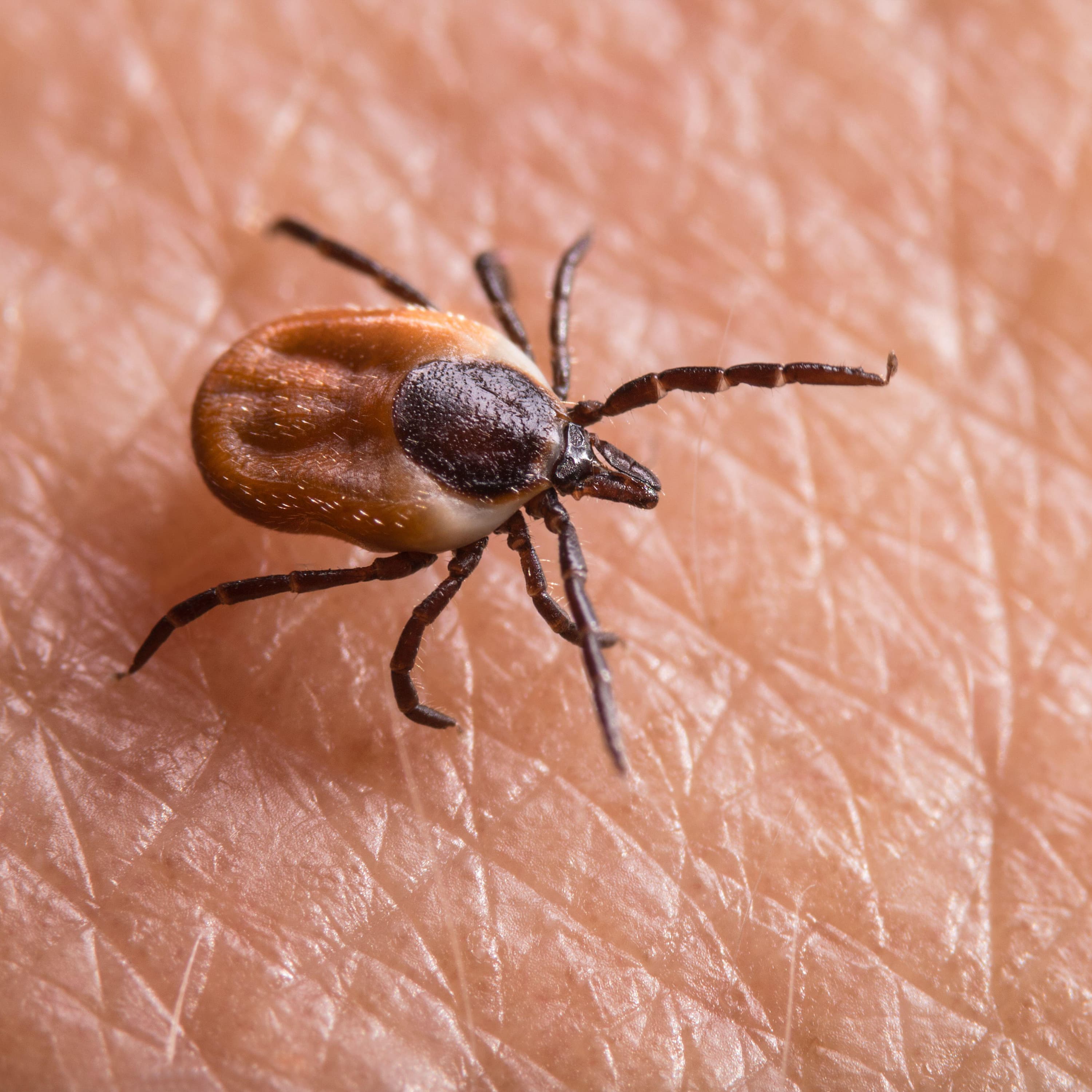 Why is ‘chronic’ lyme disease so controversial?