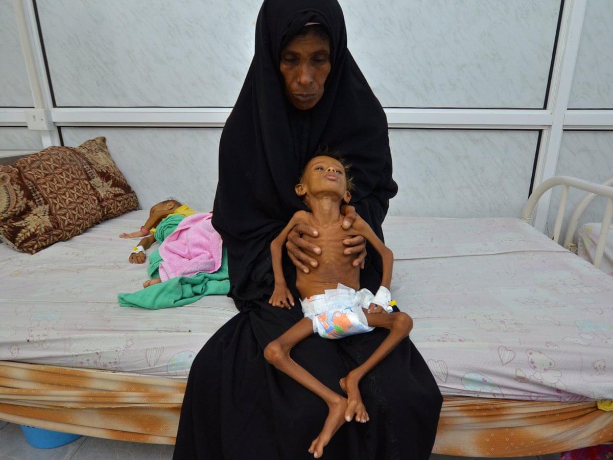 Famine in Yemen could become one of worst in living memory, UN says | Yemen | The Guardian