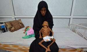 Yemen famine