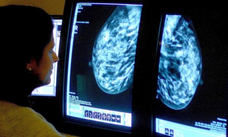 Nice recommends that the breast cancer drug palbociclib should not be routinely funded on the NHS in England.