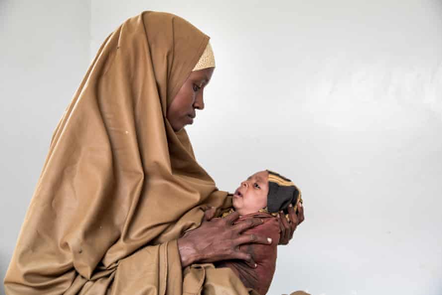 Many of the infants seen at the clinic are malnourished