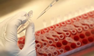 One global health expert said the US refusal was a ‘real blow’ to the global effort to secure a vaccine.
