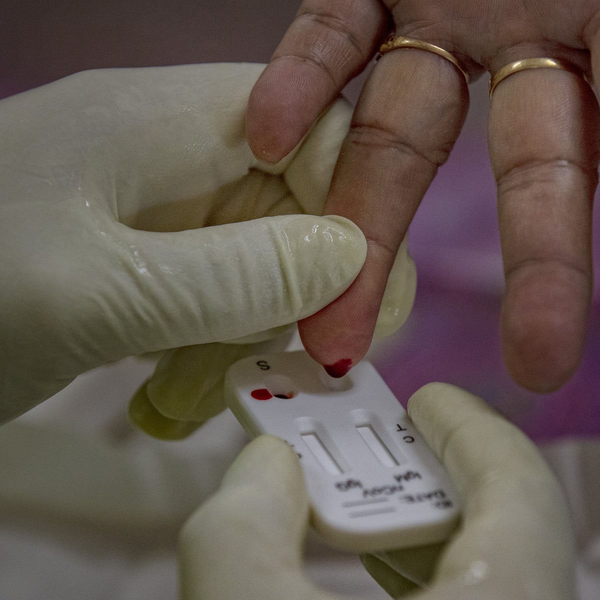 Coronavirus Antibody Tests Would Put Up To Quarter Of Those Told