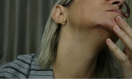 A Brazilian reporter who was roughed up by Bolsonaro supporters in Recife