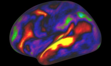 The image shows the pattern of brain activation (red, yellow) and deactivation (blue, green) in the brain’s left hemisphere when listening to stories while in an MRI scanner.