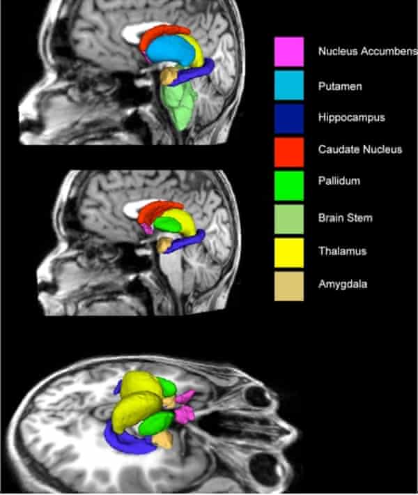 Structures of the brain that were investigated in the research published in the journal Plos One. The caudate nucleus, which was found to be able to predict levels of autistic traits in ADHD participants, is shown in red.