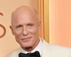 Show us your dome! Hot, balding, confident men are bringing sexy back | Rebecca Shaw