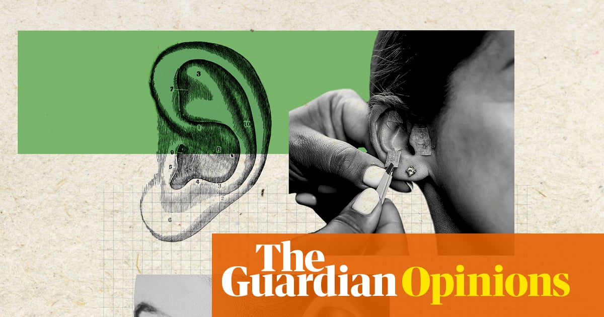 Ear seeding: can an ancient wellness technique really de-puff your face?