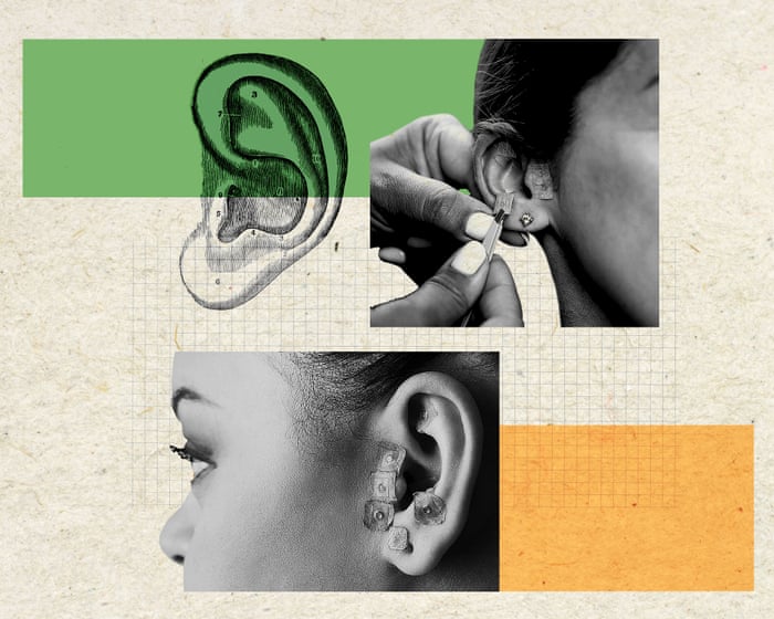 Ear seeding: can an ancient wellness technique really de-puff your face? | Antiviral