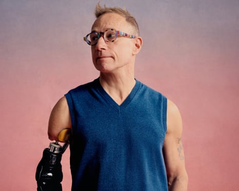Jim Ashworth-Beaumont with his new prosthetic arm