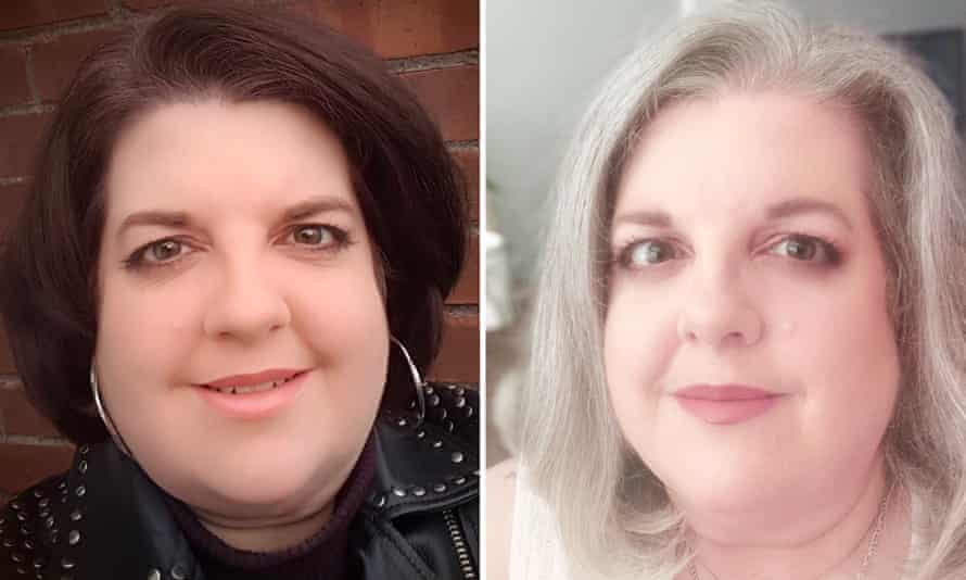 Caroline Marks before and after