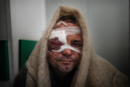 Serhiy Kralya, 41, injured during shelling by Russian forces, after surgery at a hospital in Mariupol, 11 March.