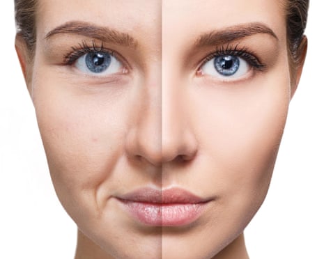 Woman's face: left side tired and lined, right side fresh and rejuvenated.