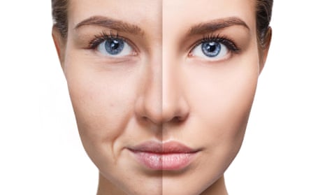 Woman's face: left side tired and lined, right side fresh and rejuvenated.