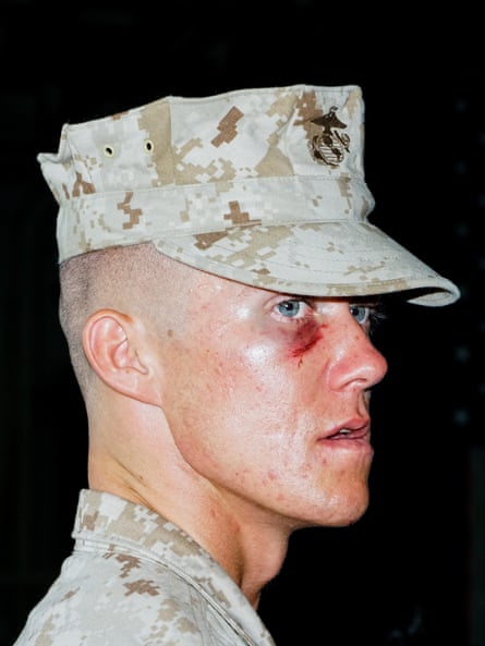 A soldier in uniform with a bruised eye