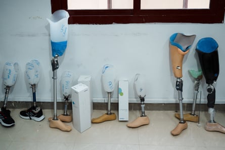 Row of customised prosthetic limbs