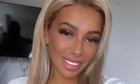 Woman who died after ‘butt lift’ surgery did not give informed consent, Bolton coroner rules