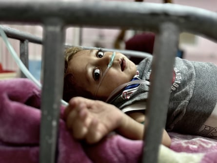 A small child lying in a hospital bed looking at the camera