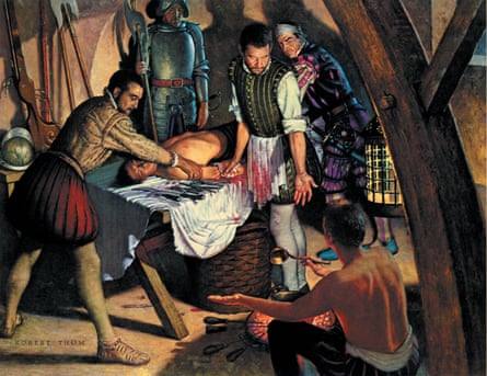 Is the body key to understanding consciousness? 1 ambroise paré at work in an illustration by robert thom