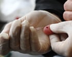 NHS Health Spending Shift Leaves Primary Care Underfunded, Warns Public Health Expert