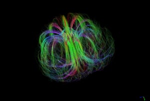 MRI tractography map of a developing Burderkin plum, specifically the fibrous structures that supply various nutrients.