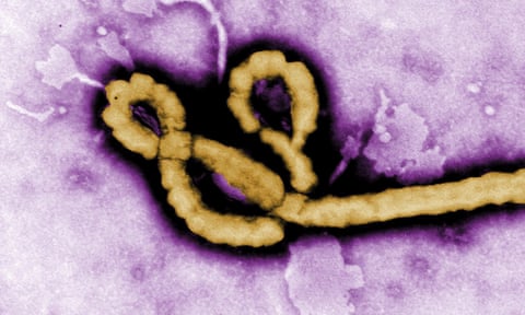 Ebola virus under an electron microscope