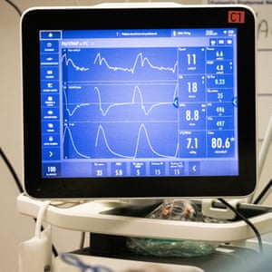 Vital signs of a patient
