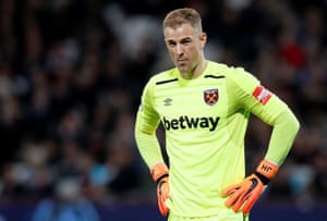 Joe Hart reacts.