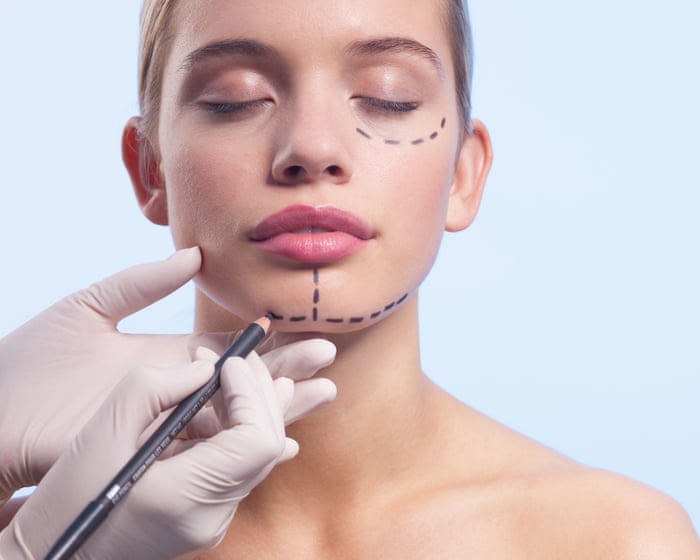 The Guardian view on regulating cosmetic procedures: rogue operators must be tackled, but aren’t the only problem | Editorial