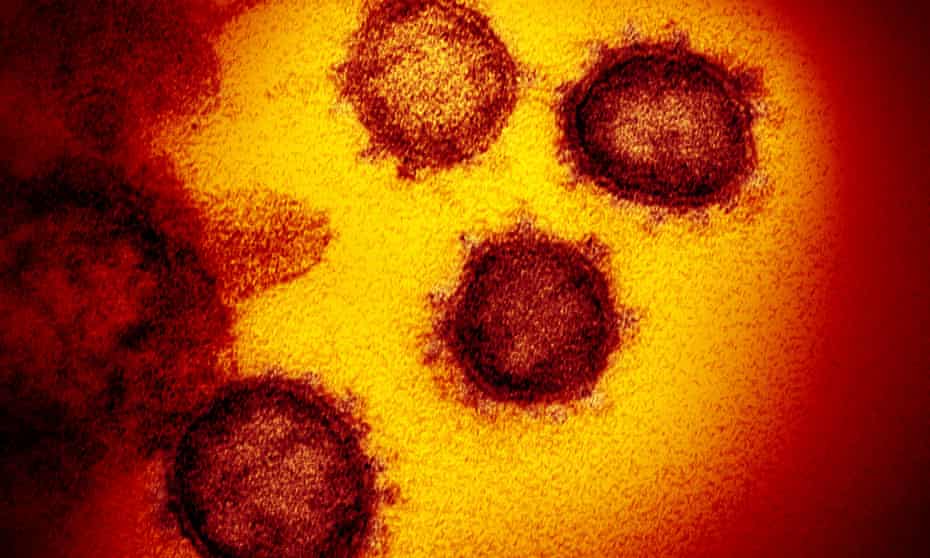 Electron microscope image of the Covid-19 virus