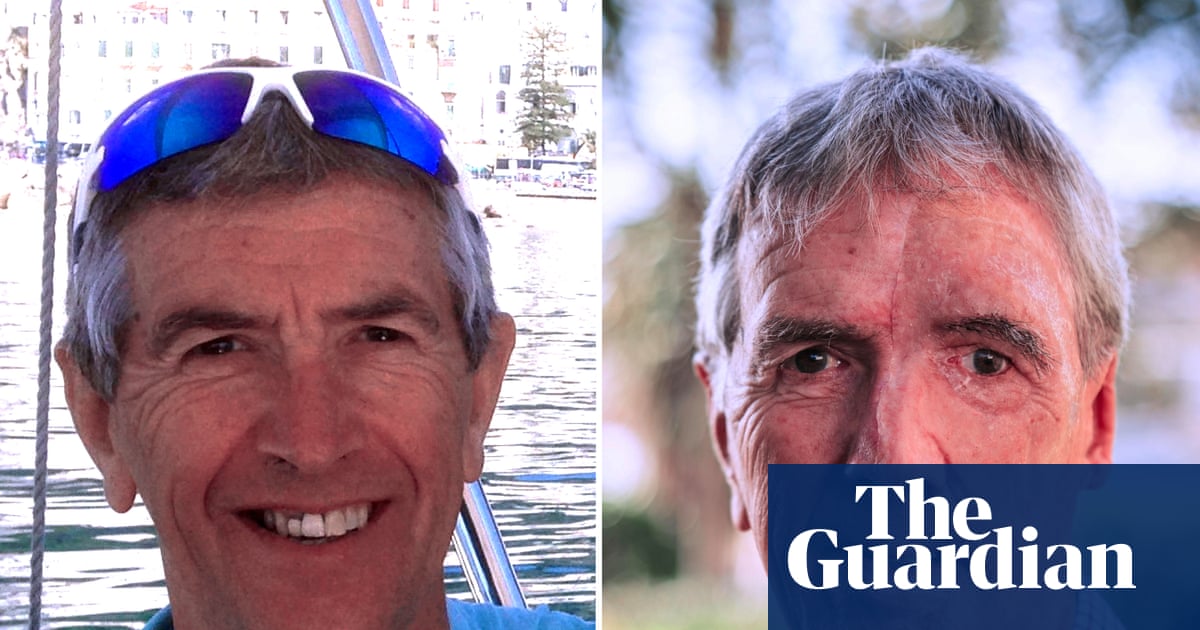 Cyclist gets 3D-printed face after drunk driver left him with third-degree burns