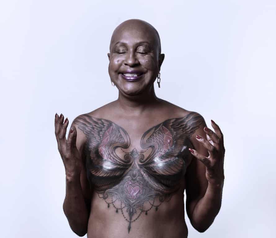 After mastectomy reconstruction no reconstruction is