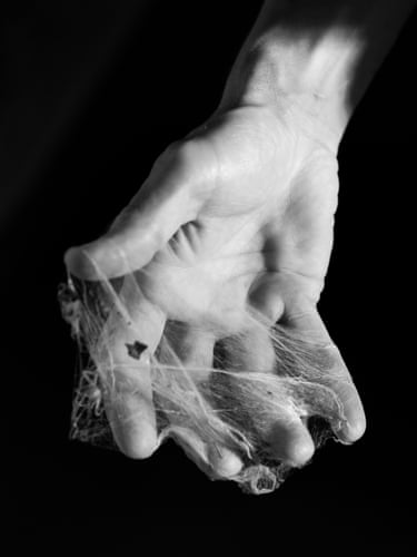 A hand with Dupuytren’s contracture, clenched and covered in tangled cobwebs
