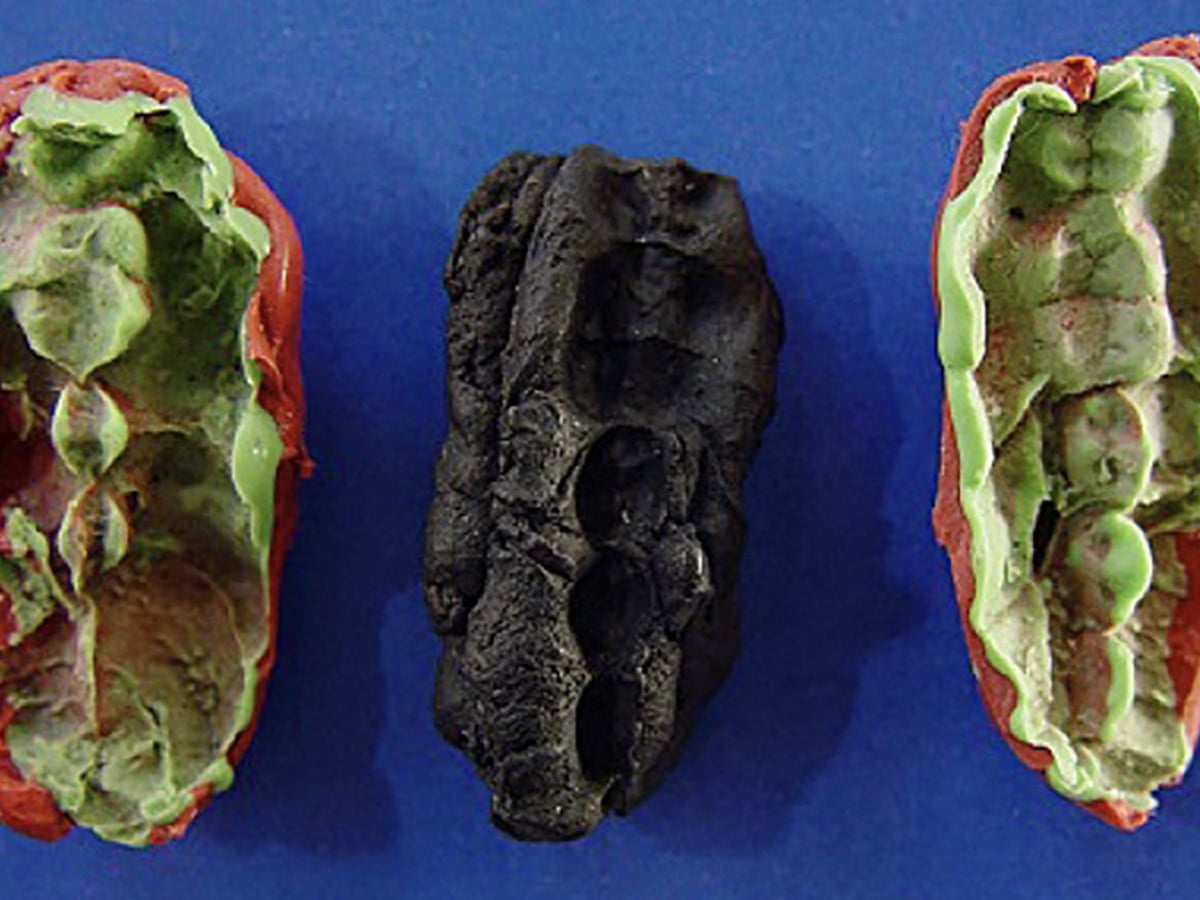 oldest chewing tobacco Ancient 'chewing gum' sheds light on stone age teenagers' diet | Archaeology oldest chewing tobacco Ancient 'chewing gum' sheds light on stone age teenagers' diet | Archaeology