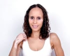 Overcoming Vitiligo: A Comedian's Journey From Hiding Skin Conditions to Embracing Self-Acceptance