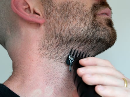 Middle-aged man uses a beard trimmer on bristles on his neck