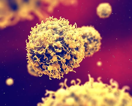 Cancer cells spreading inside organism, Metastasis