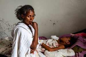 A small girl, Genet Tsegay, whose right arm has been amputated, lies on a hospital bed while her mother, Tsigabu Gebreterisae, looks away