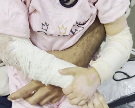 Gaza bombs investigation