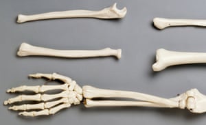 What Were Bones Of Contention In The Bone Wars The Weekend