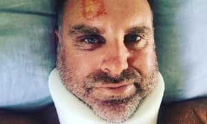 cricket great matthew hayden suffers spinal injuries while surfing