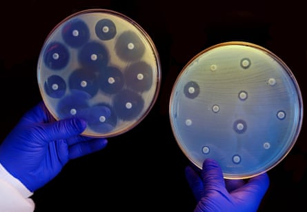 Gloved hands holding two plates. One has small discs surrounded by darker areas; in the other, the darker areas around the discs are much smaller or non-existent