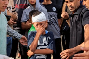 Weeping child with bandaged head surrounded by people