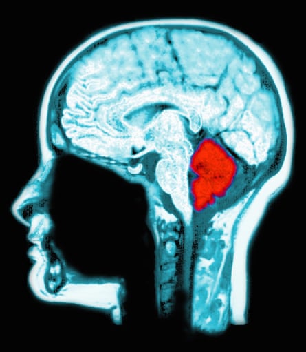 The cerebellum (in red).