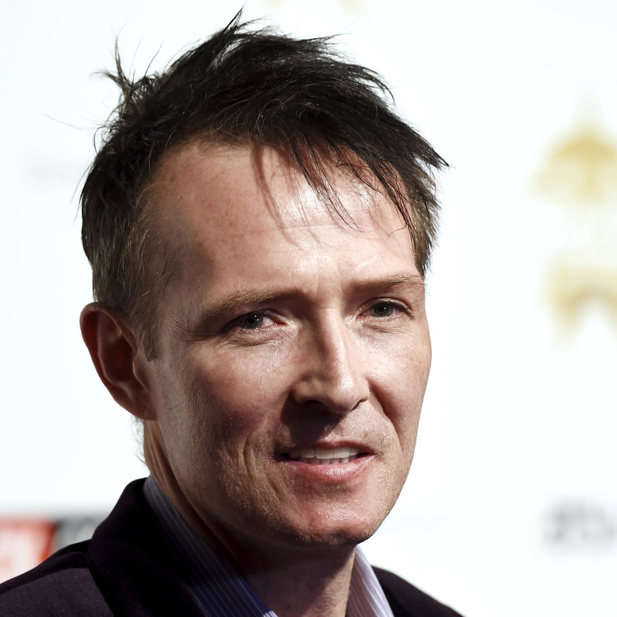 Scott Weiland Before And After